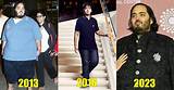 Anant Ambani's Troubling Health Battle
