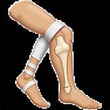 Find the Perfect Broken Leg Emoji: Express Yourself with Emotion